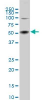 Western Blot: SGK2 Antibody (2F6) [H00010110-M07]