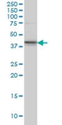 Western Blot: SGK2 Antibody (3D2) [H00010110-M09]