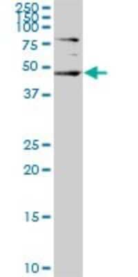 Western Blot: SGK2 Antibody (4G4) [H00010110-M05]