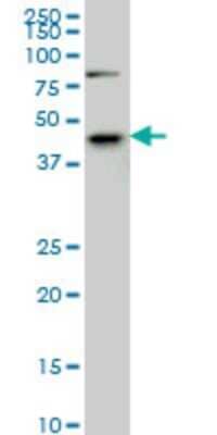 Western Blot: SGK2 Antibody (7C7) [H00010110-M08]