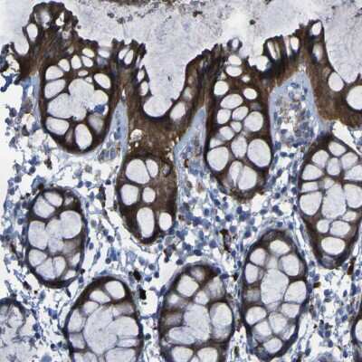 Immunohistochemistry-Paraffin: SGK2 Antibody [NBP1-86102]