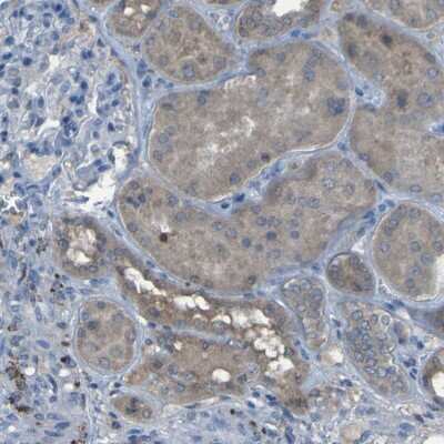 Immunohistochemistry-Paraffin: SGK2 Antibody [NBP1-86102]