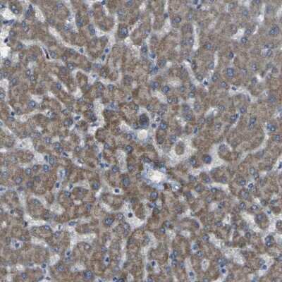 Immunohistochemistry-Paraffin: SGK2 Antibody [NBP1-86102]