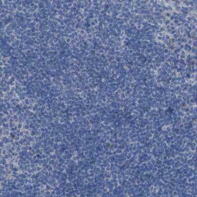 Immunohistochemistry-Paraffin: SGK2 Antibody [NBP1-86102]