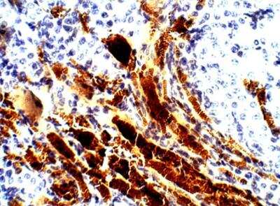 Immunohistochemistry-Paraffin: SGK2 Antibody [NBP3-12344]