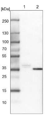 Western Blot: SGK2 Antibody [NBP1-86102]