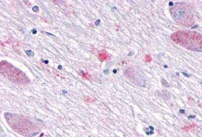 Immunohistochemistry: SGK3 Antibody - BSA Free [NB100-59014]