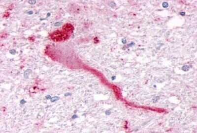 Immunohistochemistry: SGK3 Antibody - BSA Free [NB100-59014]