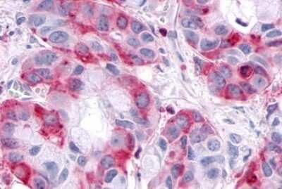 Immunohistochemistry-Paraffin: SGK3 Antibody - BSA Free [NB100-59014]