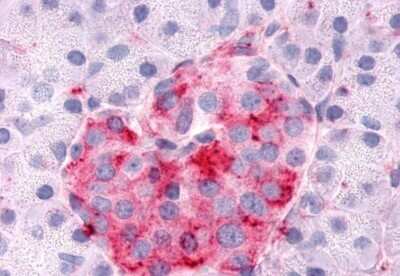 Immunohistochemistry-Paraffin: SGK3 Antibody - BSA Free [NB100-59014]