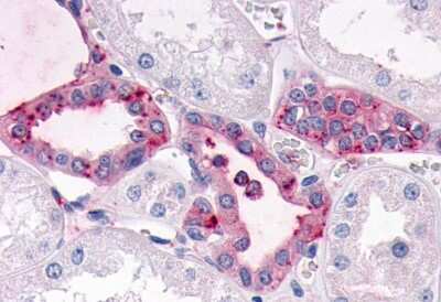 Immunohistochemistry-Paraffin: SGK3 Antibody - BSA Free [NB100-59014]
