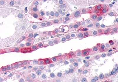 Immunohistochemistry-Paraffin: SGK3 Antibody - BSA Free [NB100-59014]