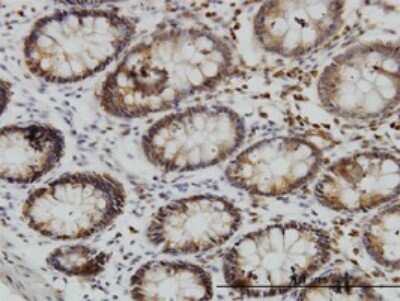 Immunohistochemistry-Paraffin: SGK3 Antibody (2A7) [H00023678-M02]