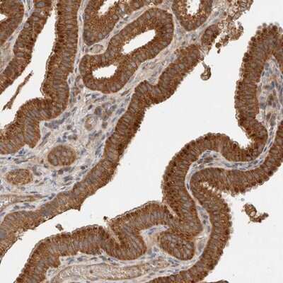 Immunohistochemistry-Paraffin: SGK3 Antibody [NBP1-80760]