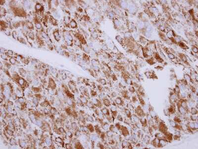 Immunohistochemistry-Paraffin: SGK3 Antibody [NBP2-20336]