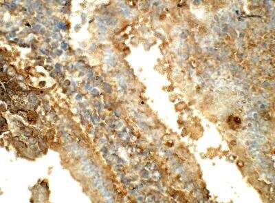 Immunohistochemistry-Paraffin: SGK3 Antibody [NBP3-12271]
