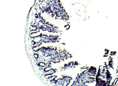 Immunohistochemistry-Paraffin: SGK3 Antibody [NBP3-12271]