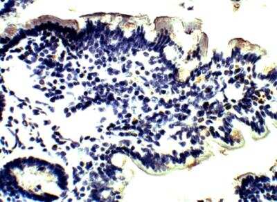 Immunohistochemistry-Paraffin: SGK3 Antibody [NBP3-12271]