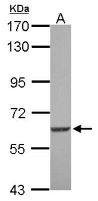 Western Blot: SGK3 Antibody [NBP2-20337]