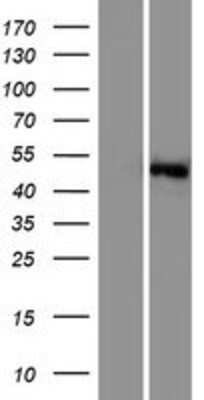 Western Blot: SGK3 Overexpression Lysate [NBP2-05212]