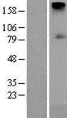 Western Blot: SGLT1/SLC5A1 Overexpression Lysate [NBL1-16171]