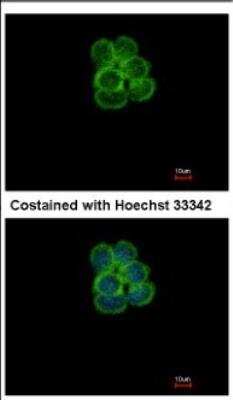 Immunocytochemistry/ Immunofluorescence: SGLT1/SLC5A1 Antibody [NBP2-20338]