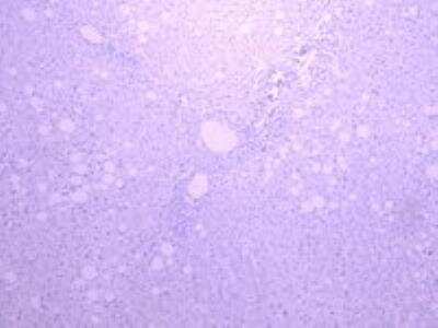 Immunohistochemistry-Paraffin: SGLT1/SLC5A1 Antibody [NBP2-27565]