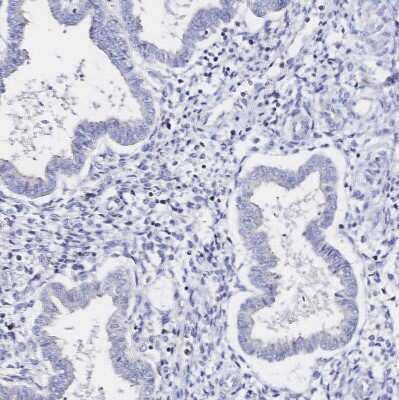 Immunohistochemistry-Paraffin: SGLT1/SLC5A1 Antibody [NBP2-33629]