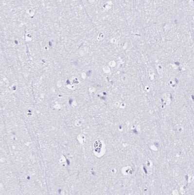 Immunohistochemistry-Paraffin: SGLT1/SLC5A1 Antibody [NBP2-38748]