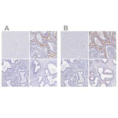 Immunohistochemistry-Paraffin: SGLT1/SLC5A1 Antibody [NBP2-38748]