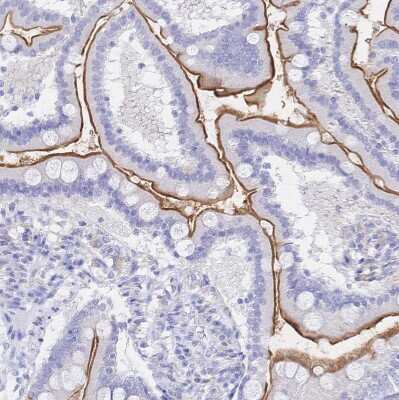Immunohistochemistry-Paraffin: SGLT1/SLC5A1 Antibody [NBP2-38748]