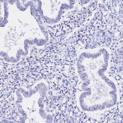 Immunohistochemistry-Paraffin: SGLT1/SLC5A1 Antibody [NBP2-38748]