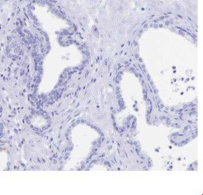 Immunohistochemistry-Paraffin: SGLT1/SLC5A1 Antibody [NBP2-38748]