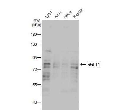 Western Blot: SGLT1/SLC5A1 Antibody [NBP2-20338]