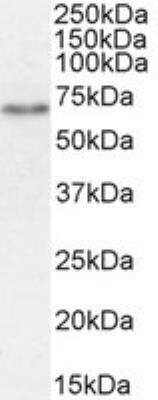 Western Blot: SGLT1/SLC5A1 Antibody [NBP2-27565]