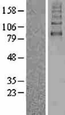 Western Blot: SGLT2/SLC5A2 Overexpression Lysate [NBL1-16173]