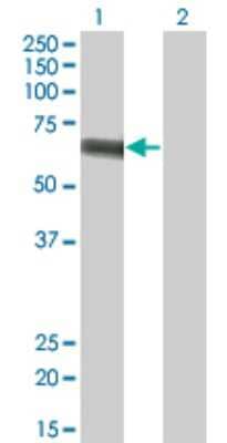 Western Blot: SGLT2/SLC5A2 Antibody (3G8) [H00006524-M01]