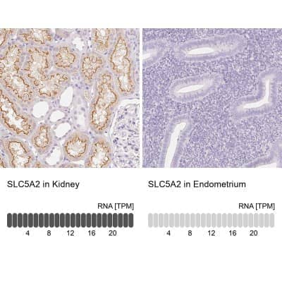 Immunohistochemistry-Paraffin: SGLT2/SLC5A2 Antibody [NBP1-92384]