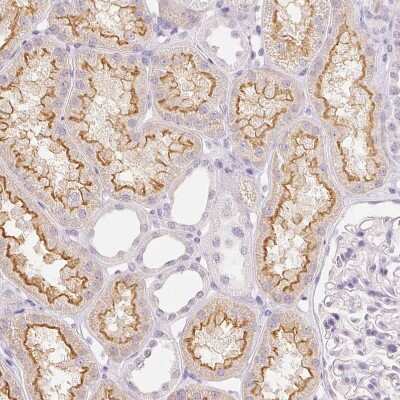 Immunohistochemistry-Paraffin: SGLT2/SLC5A2 Antibody [NBP1-92384]