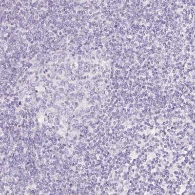 Immunohistochemistry-Paraffin: SGLT2/SLC5A2 Antibody [NBP1-92384]