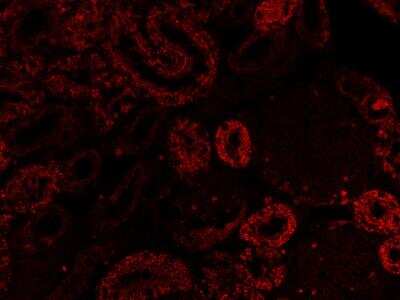 Immunohistochemistry-Paraffin: SGLT2/SLC5A2 Antibody [NBP1-92384]