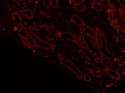 Immunohistochemistry-Paraffin: SGLT2/SLC5A2 Antibody [NBP1-92384]