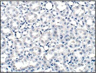 Immunohistochemistry-Paraffin: SGLT2/SLC5A2 Antibody [NBP3-12231]