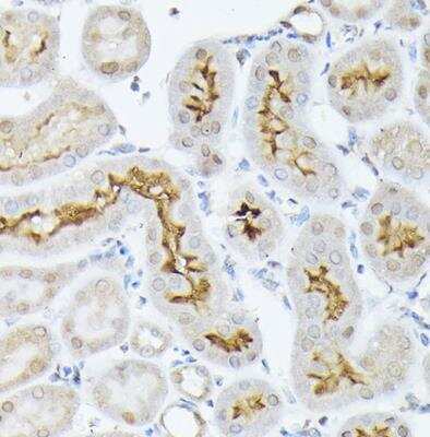 Immunohistochemistry-Paraffin: SGLT2/SLC5A2 Antibody - Azide and BSA Free [NBP3-15989]