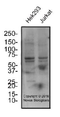 Western Blot: SGLT2/SLC5A2 AntibodyBSA Free [NBP2-77441]