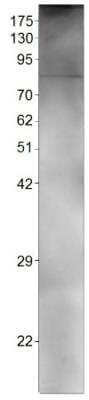 Western Blot: SGLT2/SLC5A2 Antibody [NBP3-12231]