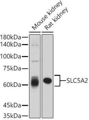 Western Blot: SGLT2/SLC5A2 AntibodyAzide and BSA Free [NBP3-15989]