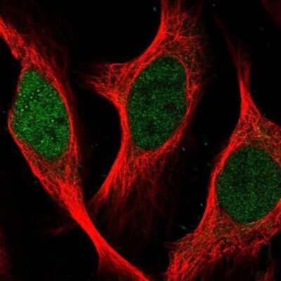 Immunocytochemistry/ Immunofluorescence: SGOL2 Antibody [NBP2-58930]