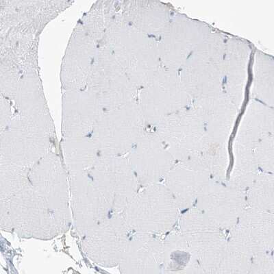 Immunohistochemistry-Paraffin: SGOL2 Antibody [NBP1-83567]