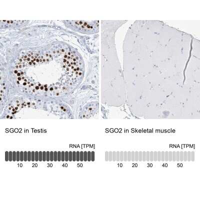 Immunohistochemistry-Paraffin: SGOL2 Antibody [NBP1-83567]